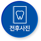 전후사진